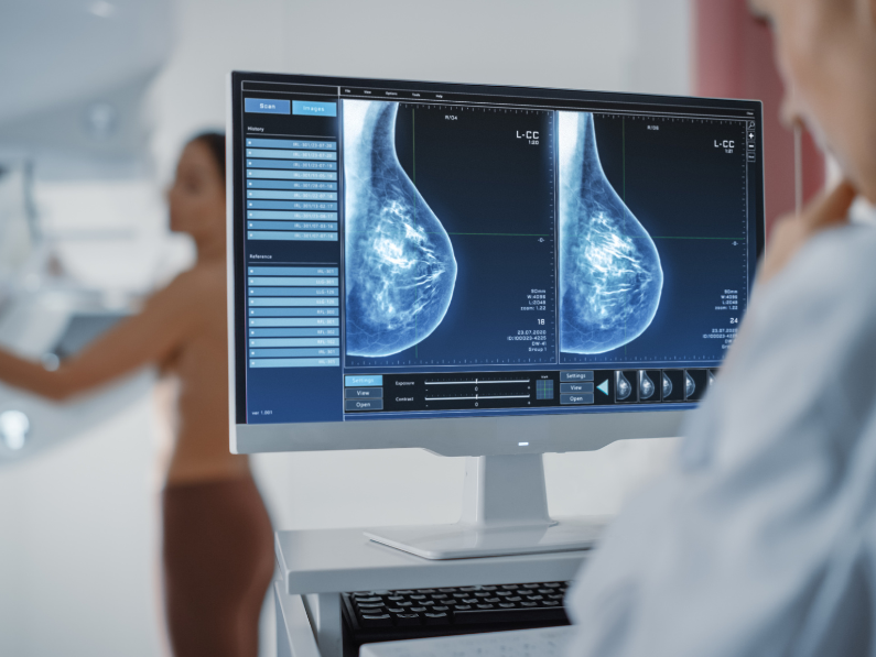 Radiation oncologist reviewing results from a patient's screening or diagnostic mammogram for breast cancer